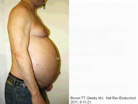Metabolic Complications of HIV (and Antiretroviral Therapy)