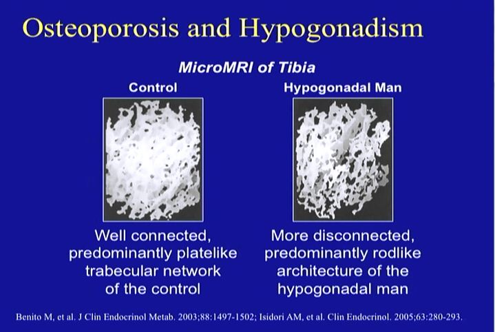 Hypogonadism in Older HIV-Infected Men: Current Concepts and Controversies