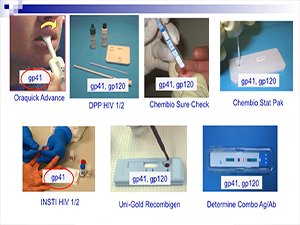 HIV Testing in the Era of PrEP