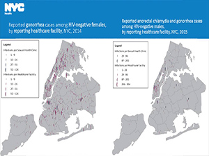 Improving the Diagnosis & Treatment of Other STIs in the Era of U=U and PrEP