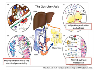 Non-alcoholic Fatty Liver Disease and Steatohepatitis in HIV Disease