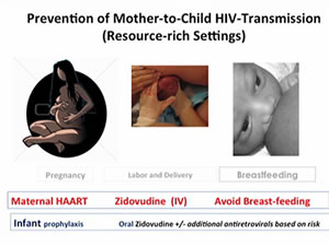 Pediatric HIV Infection: A Model for Cure