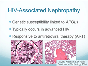Update on The Kidney in HIV Treatment and Prevention
